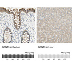 Anti-GCNT3 Antibody