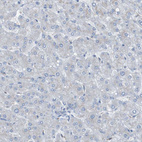 Anti-KIAA1024 Antibody