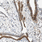 Anti-SELENBP1 Antibody