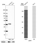 Anti-QPRT Antibody