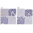 Anti-SCG2 Antibody