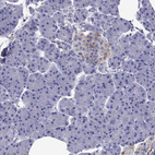 Anti-SCG2 Antibody