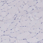 Anti-SCG2 Antibody