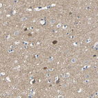 Anti-NEGR1 Antibody