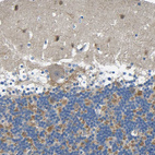 Anti-NEGR1 Antibody