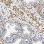 Anti-NEGR1 Antibody