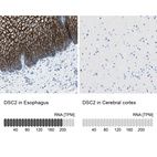 Anti-DSC2 Antibody