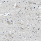 Anti-SORCS1 Antibody