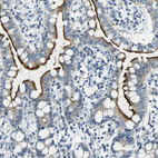 Anti-SORCS1 Antibody