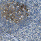 Anti-SORCS1 Antibody