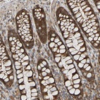 Anti-TMBIM1 Antibody