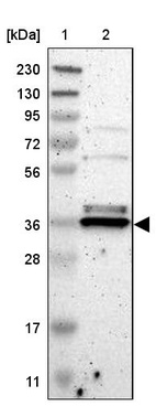 Anti-TMBIM1 Antibody