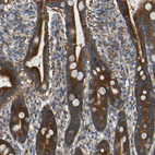 Anti-TMEM25 Antibody