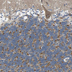 Anti-TMEM25 Antibody