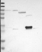 Anti-DDAH2 Antibody