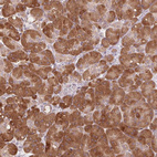 Anti-TMED6 Antibody