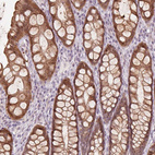 Anti-TMED6 Antibody