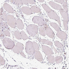 Anti-TMED6 Antibody