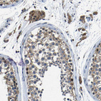 Anti-C6orf89 Antibody