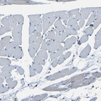 Anti-C6orf89 Antibody