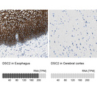 Anti-DSC2 Antibody