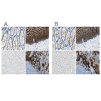 Anti-DSC2 Antibody