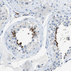 Immunohistochemical staining of human testis shows moderate cytoplasmic positivity in cells in seminiferous ducts.