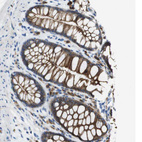 Immunohistochemical staining of human colon shows moderate membranous and cytoplasmic positivity in glandular cells.