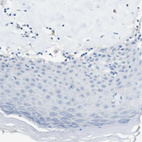 Immunohistochemical staining of human skin shows no membranous positivity in squamous epithelial cells.