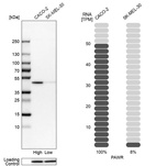 Western blot analysis in human cell lines Caco-2 and SK-MEL-30 using Anti-PAWR antibody. Corresponding PAWR RNA-seq data are presented for the same cell lines. Loading control: Anti-HDAC1.