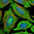 Immunofluorescent staining of human cell line SiHa shows localization to plasma membrane & actin filaments.