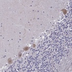 Anti-FGF3 Antibody