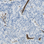 Anti-PLXDC1 Antibody