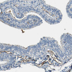 Anti-PLXDC1 Antibody