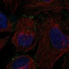 Anti-ILDR2 Antibody