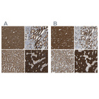 Anti-C1GALT1 Antibody