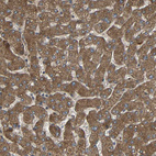 Anti-C1GALT1 Antibody