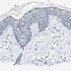 Immunohistochemical staining of human skin shows low expression as expected.