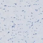 Anti-FBN2 Antibody