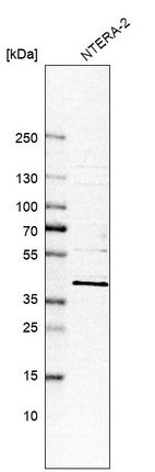 Western blot analysis in human cell line NTERA-2.