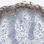 Anti-DSC1 Antibody