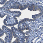 Anti-DSC1 Antibody