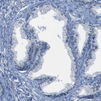 Anti-DSC1 Antibody