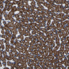 Anti-PTRH2 Antibody