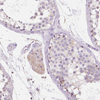 Anti-TMEM130 Antibody