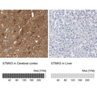 Anti-STMN3 Antibody