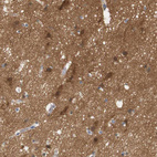 Anti-STMN3 Antibody