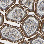 Immunohistochemical staining of human small intestine shows strong cytoplasmic positivity in glandular cells.