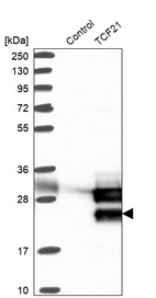 Anti-TCF21 Antibody