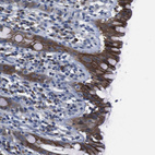 Anti-SEMA4B Antibody